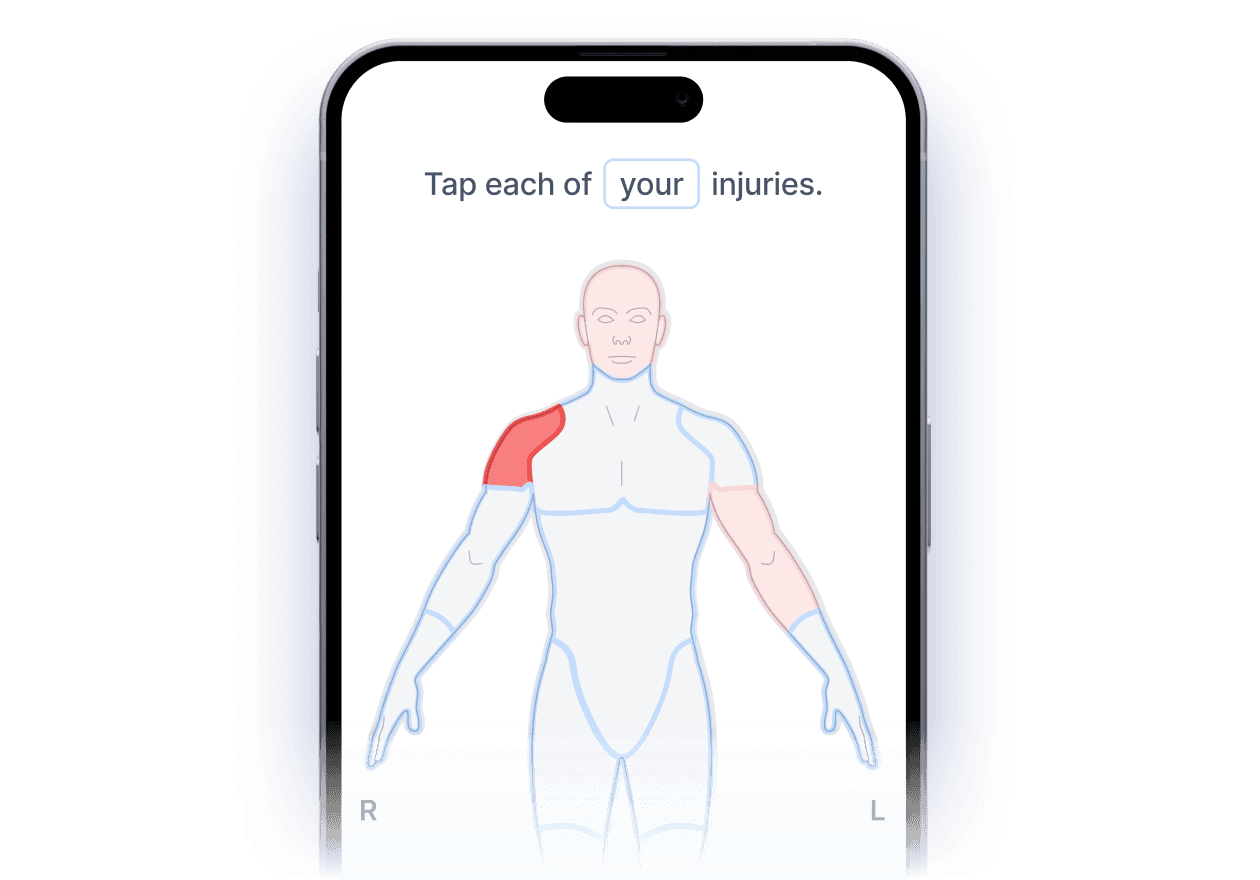 Digital FNOL visual layer